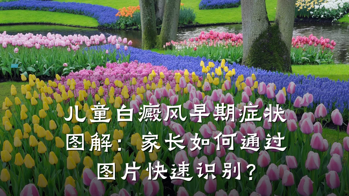 儿童白癜风早期症状图解:家长如何通过图片快速识别?