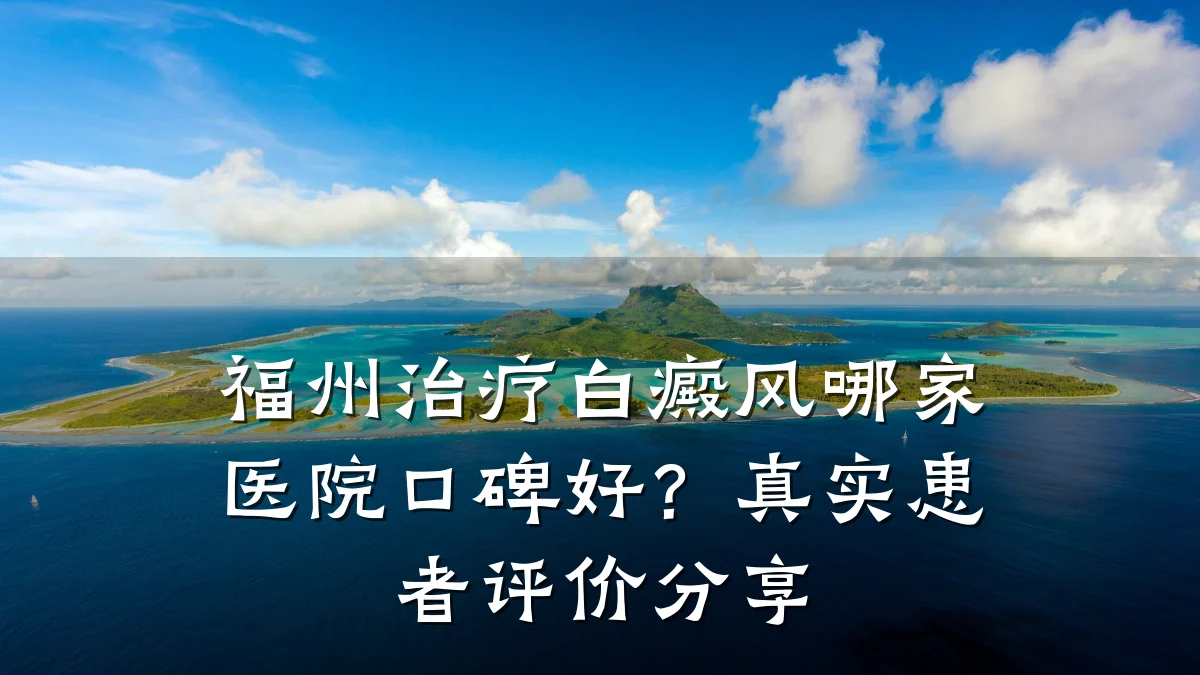 福州治疗白癜风哪家医院口碑好？真实患者评价分享