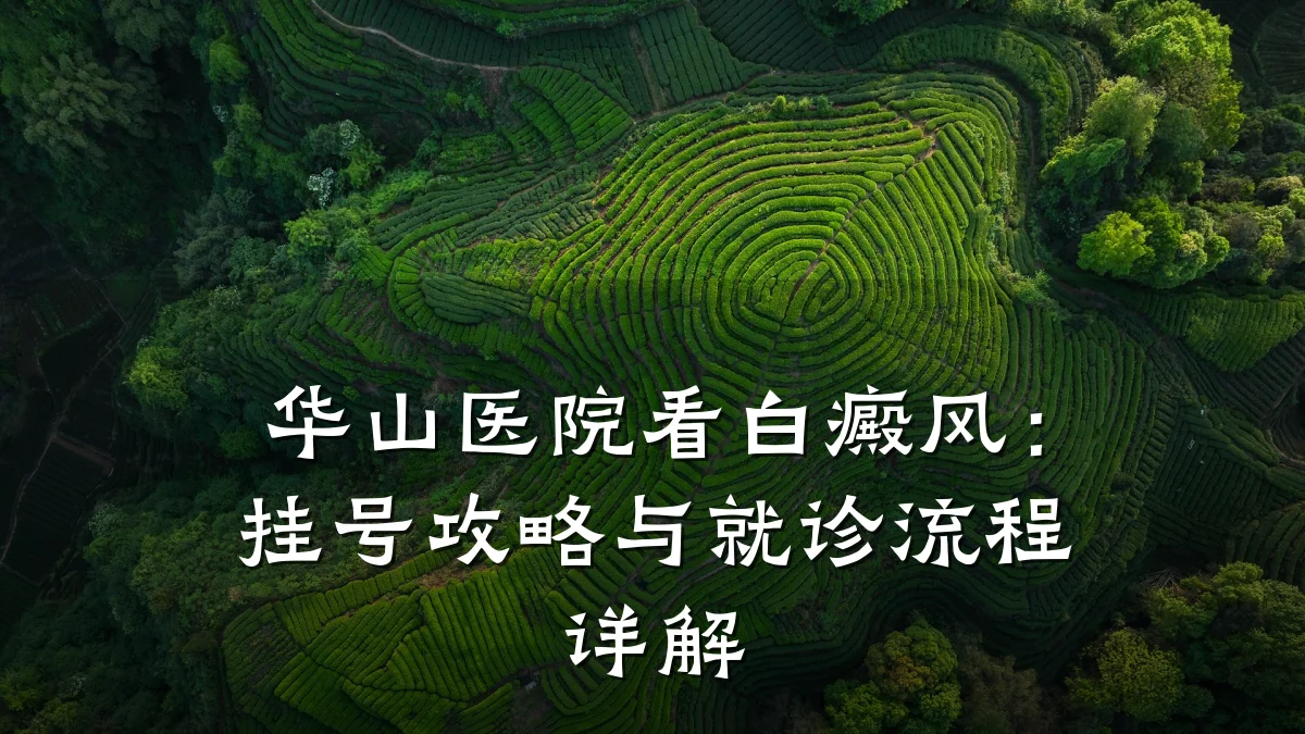 华山医院看白癜风:挂号攻略与就诊流程详解