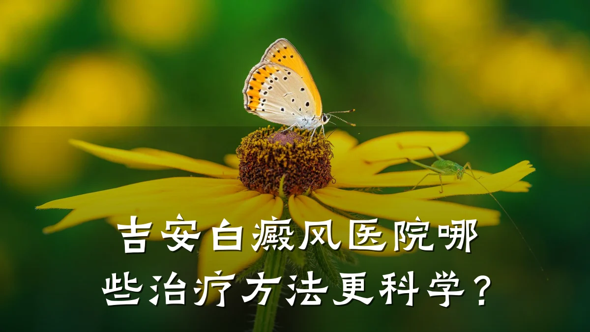 吉安白癜风医院哪些治疗方法更科学?