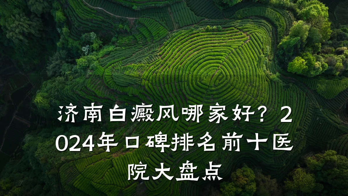 济南白癜风哪家好?2024年口碑排名前十医院大盘点