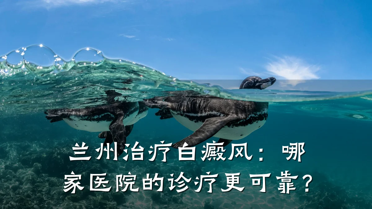 兰州治疗白癜风:哪家医院的诊疗更可靠?