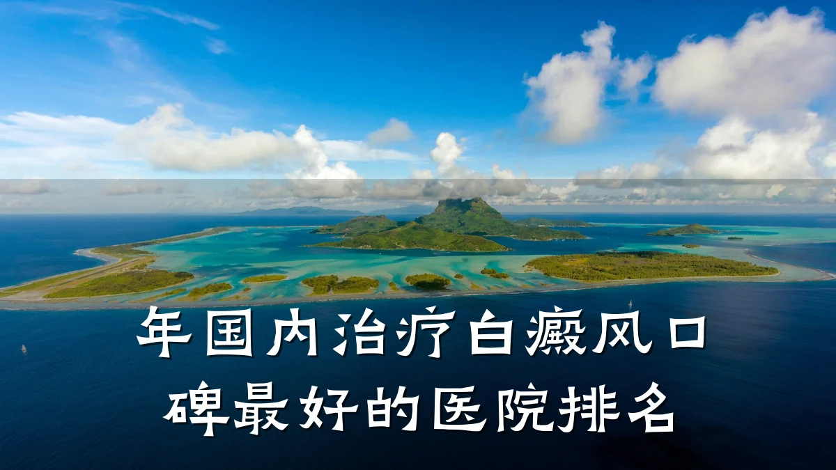 年国内治疗白癜风口碑最好的医院排名