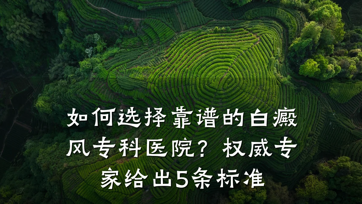 如何选择靠谱的白癜风专科医院?权威专家给出5条标准