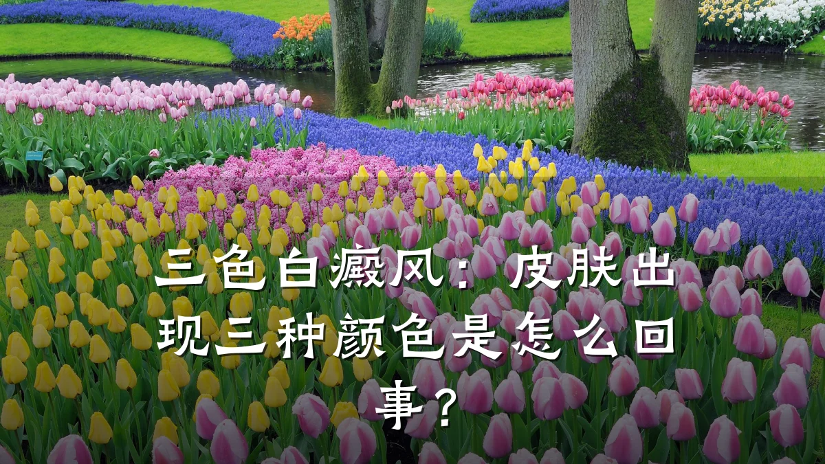 三色白癜风:皮肤出现三种颜色是怎么回事?