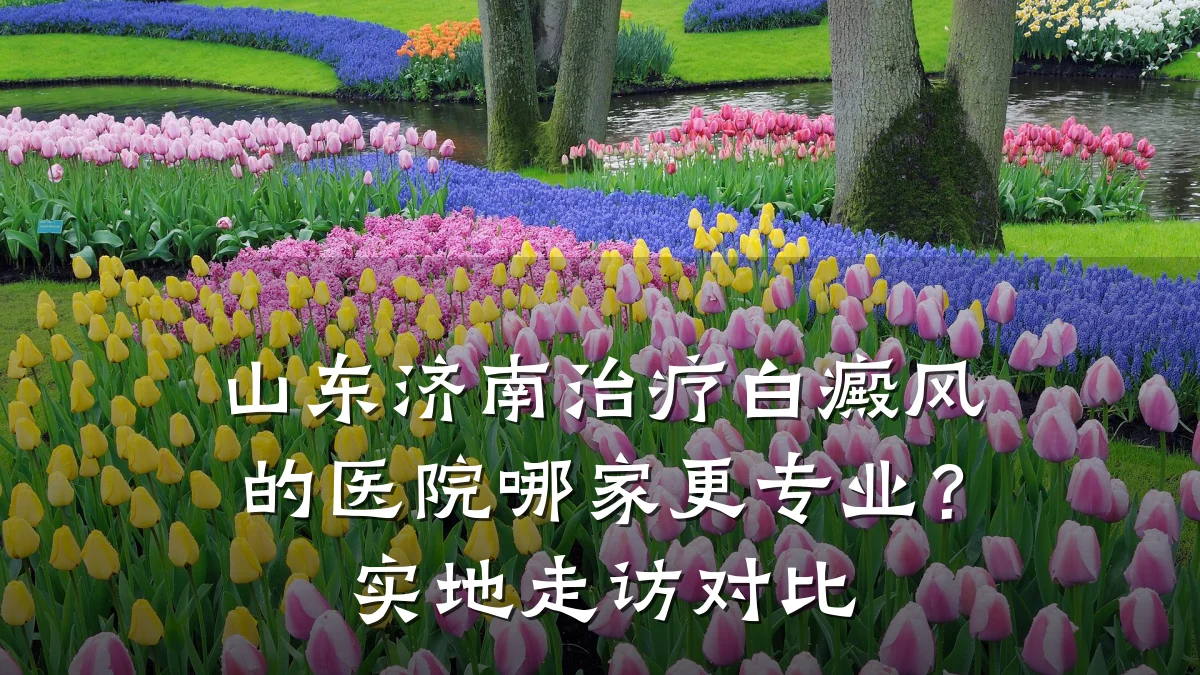 山东济南治疗白癜风的医院哪家更专业?实地走访对比