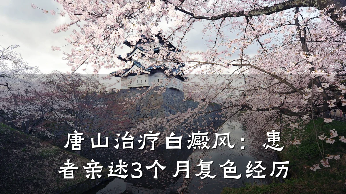 唐山治疗白癜风:患者亲述3个月复色经历