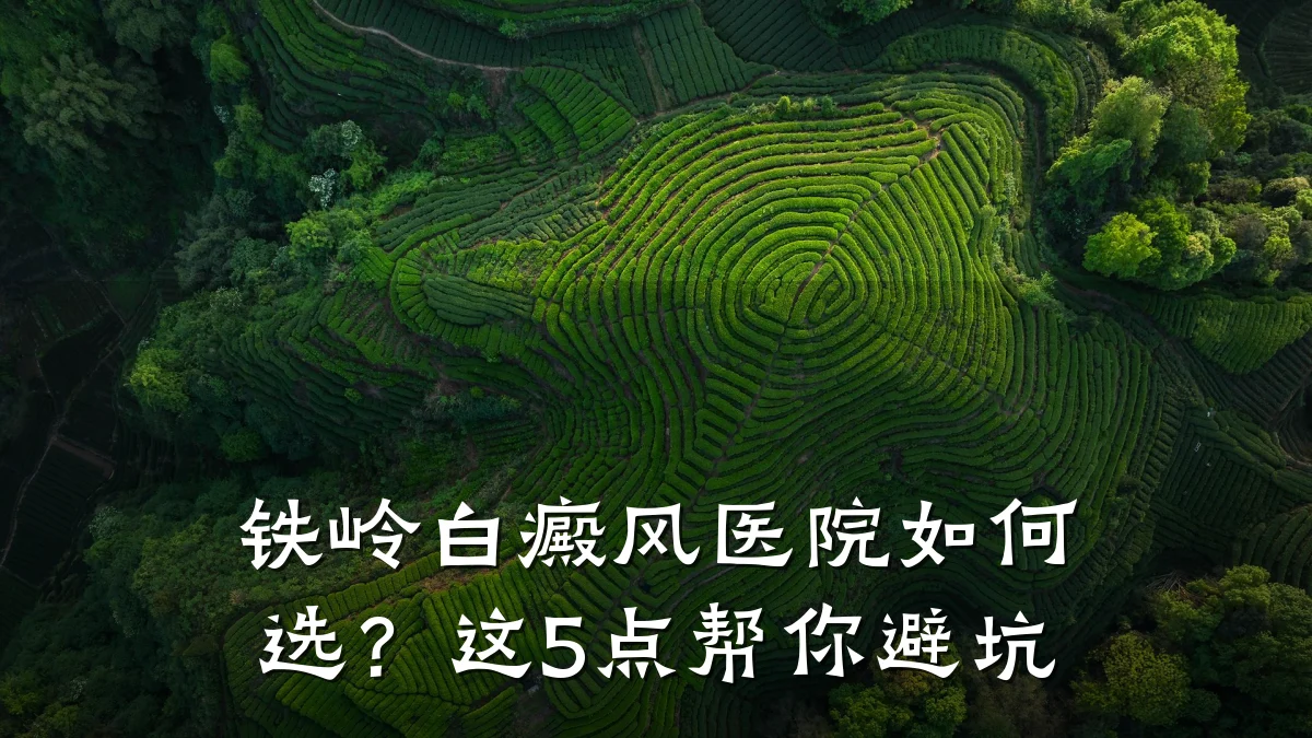 铁岭白癜风医院如何选?这5点帮你避坑