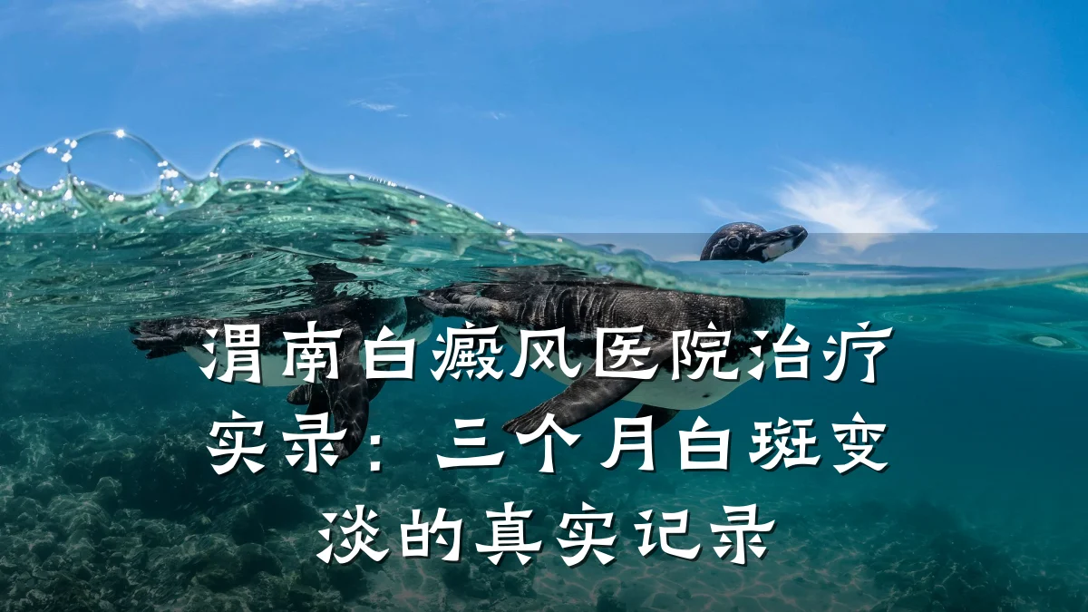 渭南白癜风医院治疗实录:三个月白斑变淡的真实记录