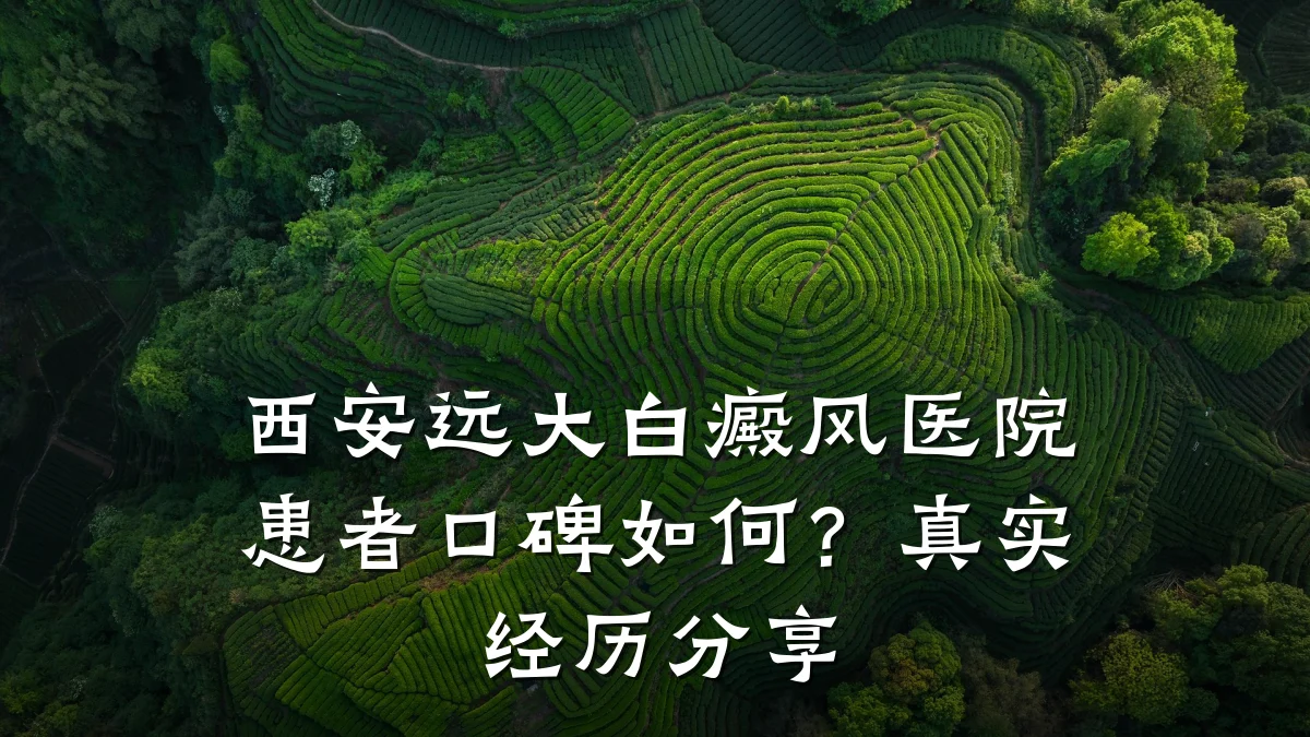 西安远大白癜风医院患者口碑如何?真实经历分享