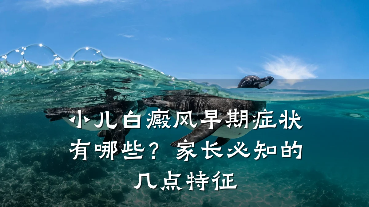 小儿白癜风早期症状有哪些?家长必知的几点特征