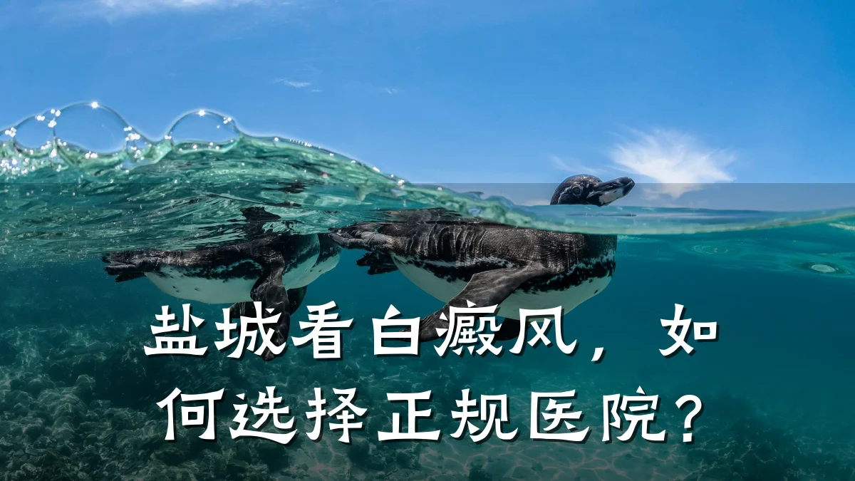 盐城看白癜风,如何选择正规医院?