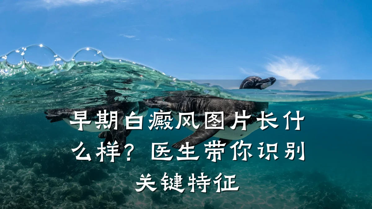 早期白癜风图片长什么样?医生带你识别关键特征