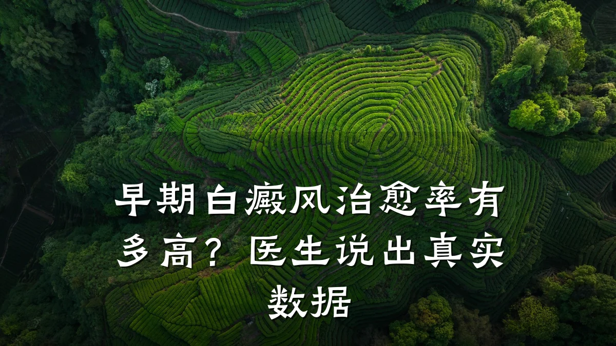 早期白癜风治愈率有多高?医生说出真实数据