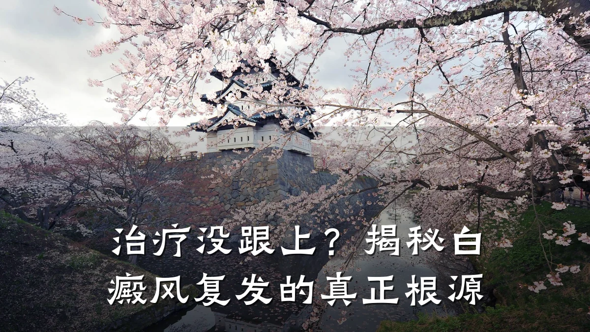 治疗没跟上?揭秘白癜风复发的真正根源