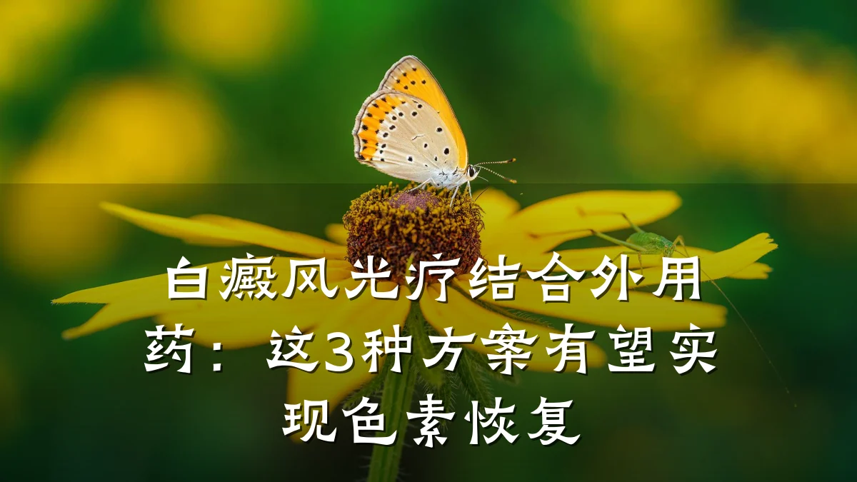 白癜风光疗结合外用药：这3种方案有望实现色素恢复
