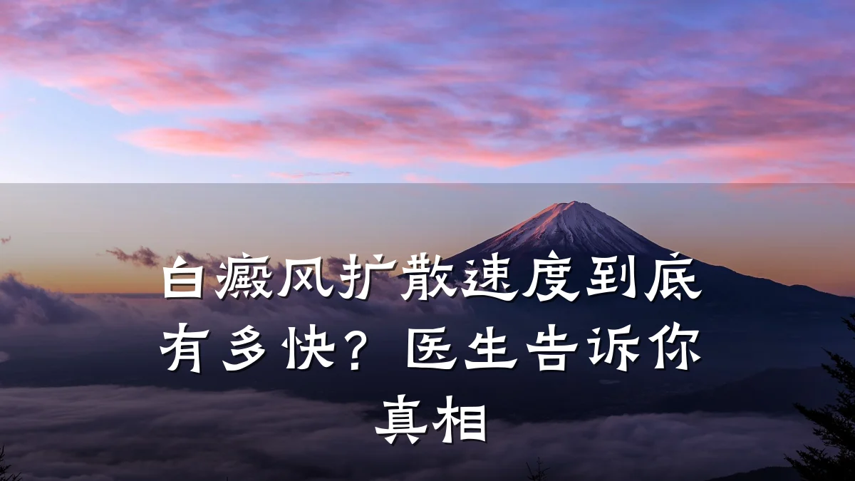 白癜风扩散速度到底有多快?医生告诉你真相