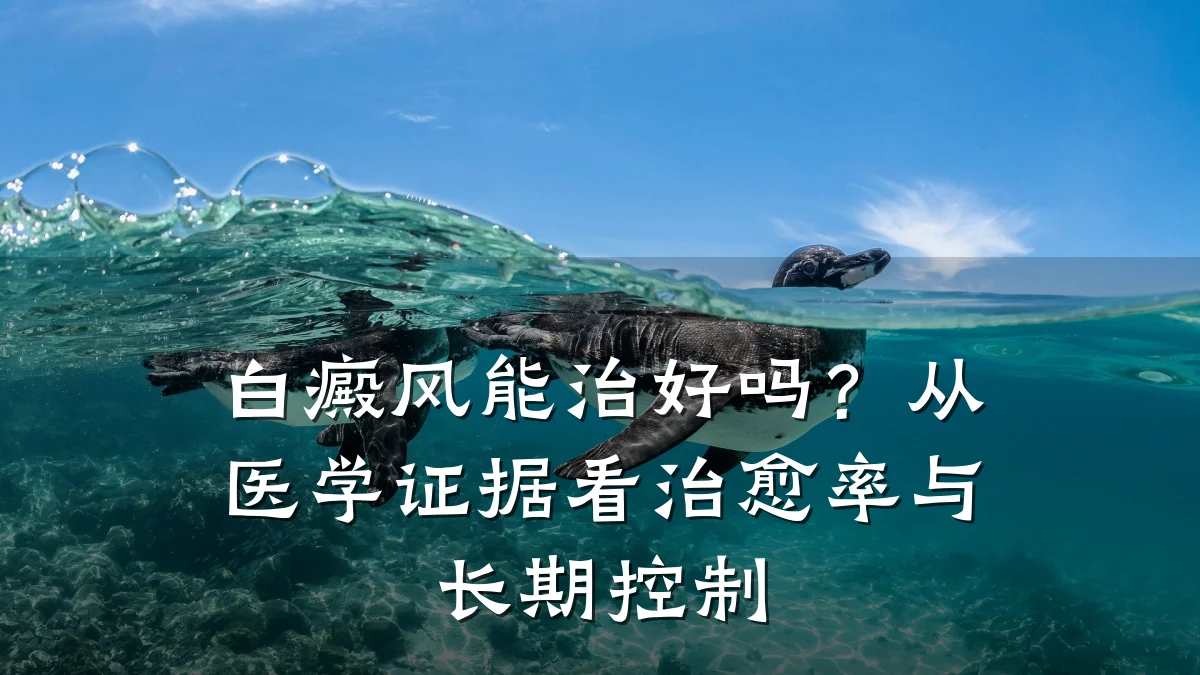 白癜风能治好吗?从医学证据看治愈率与长期控制