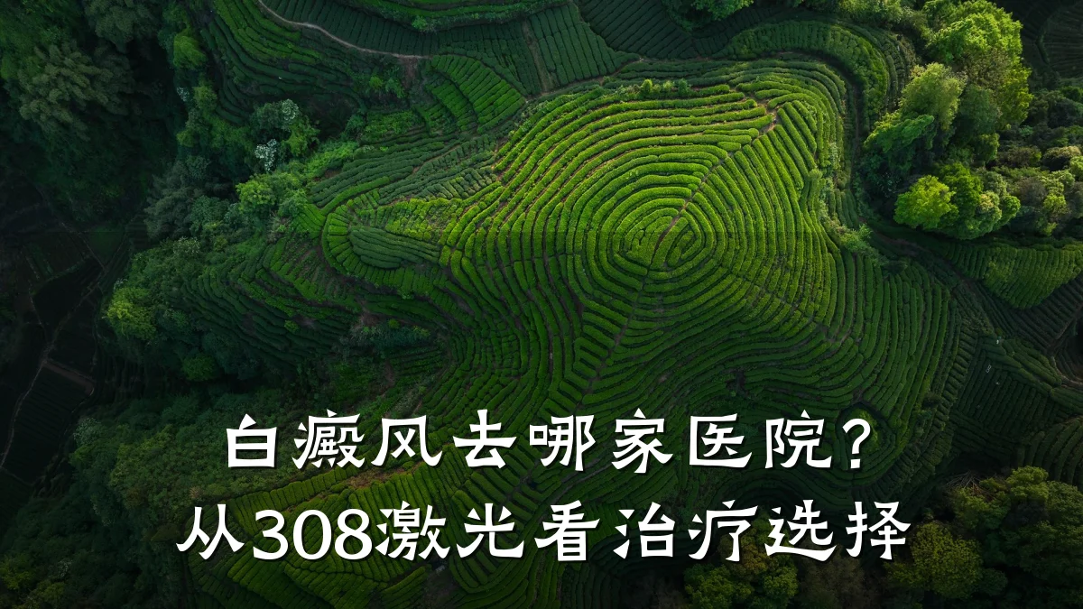 白癜风去哪家医院?从308激光看治疗选择