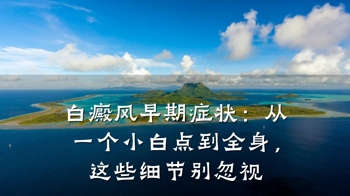 白癜风早期症状:从一个小白点到全身,这些细节别忽视