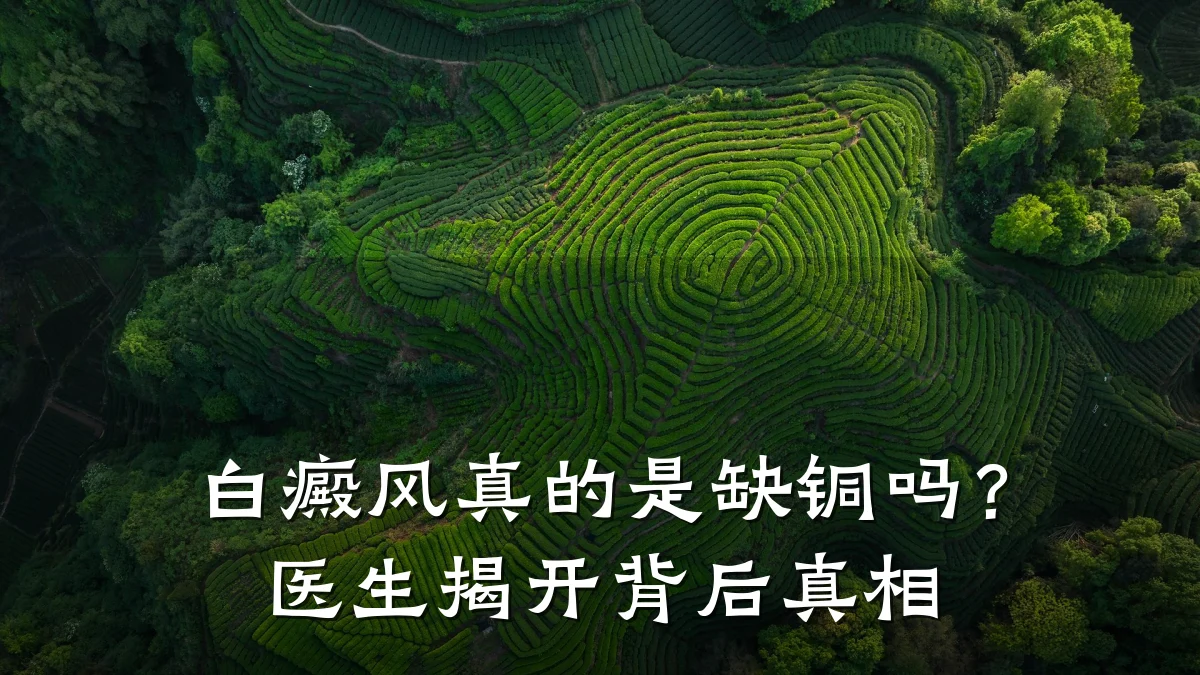 白癜风真的是缺铜吗?医生揭开背后真相