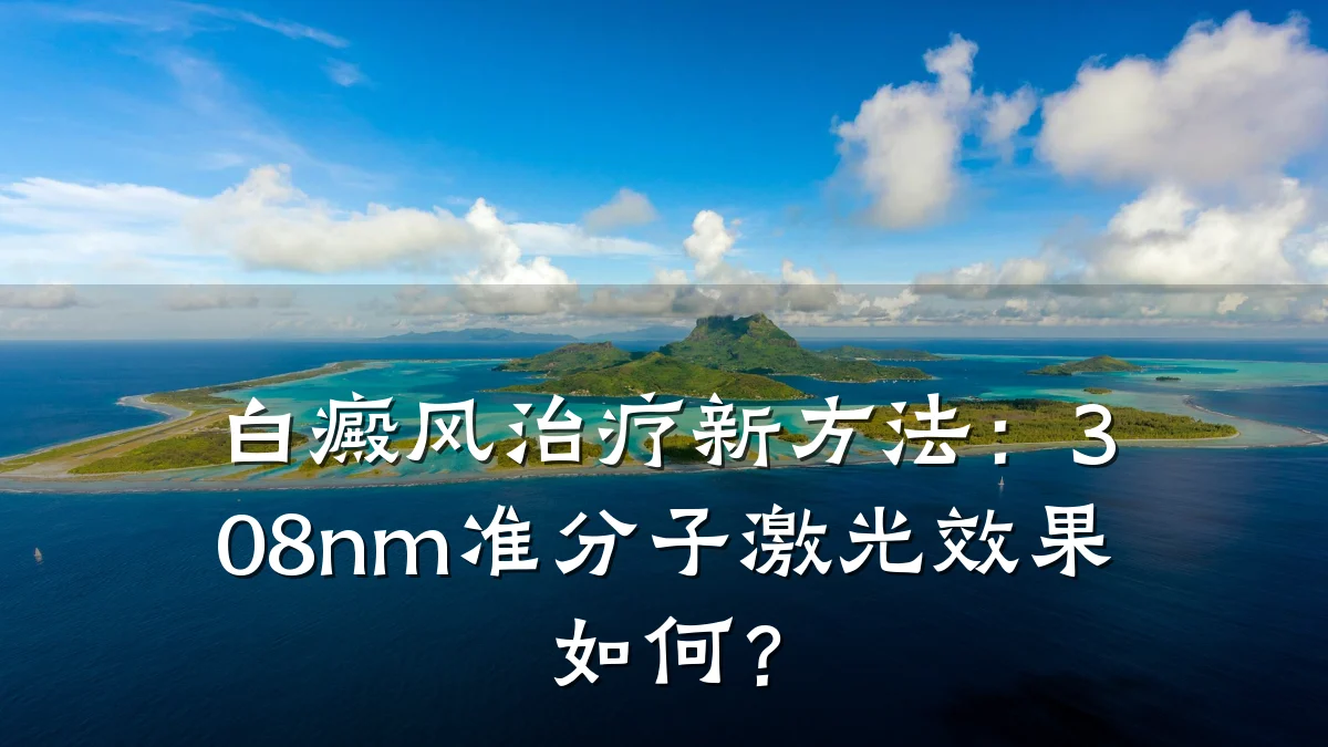白癜风治疗新方法:308nm准分子激光效果如何?