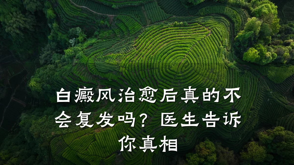 白癜风治愈后真的不会复发吗?医生告诉你真相