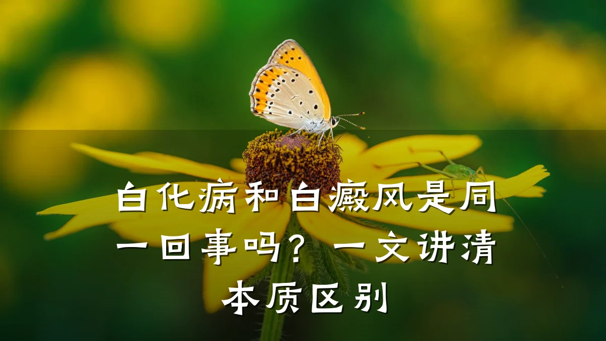 白化病和白癜风是同一回事吗?一文讲清本质区别