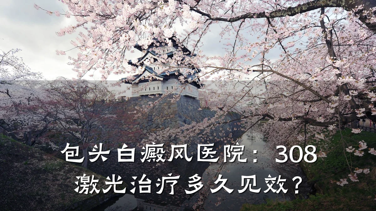 包头白癜风医院:308激光治疗多久见效?