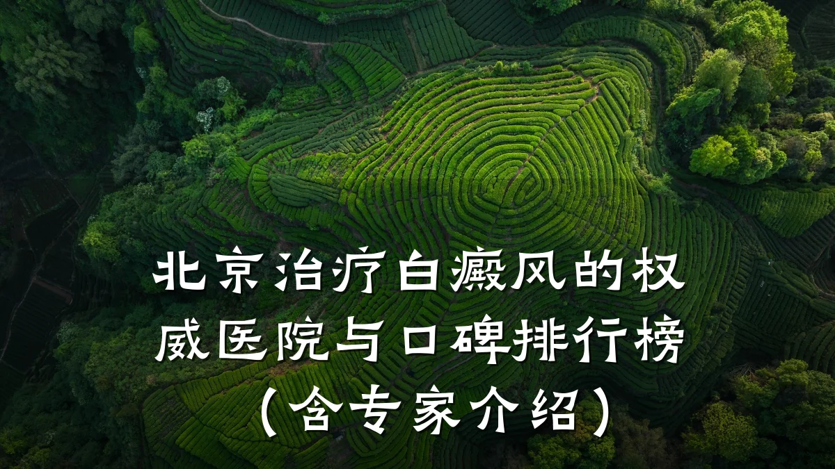 北京治疗白癜风的权威医院与口碑排行榜（含专家介绍）