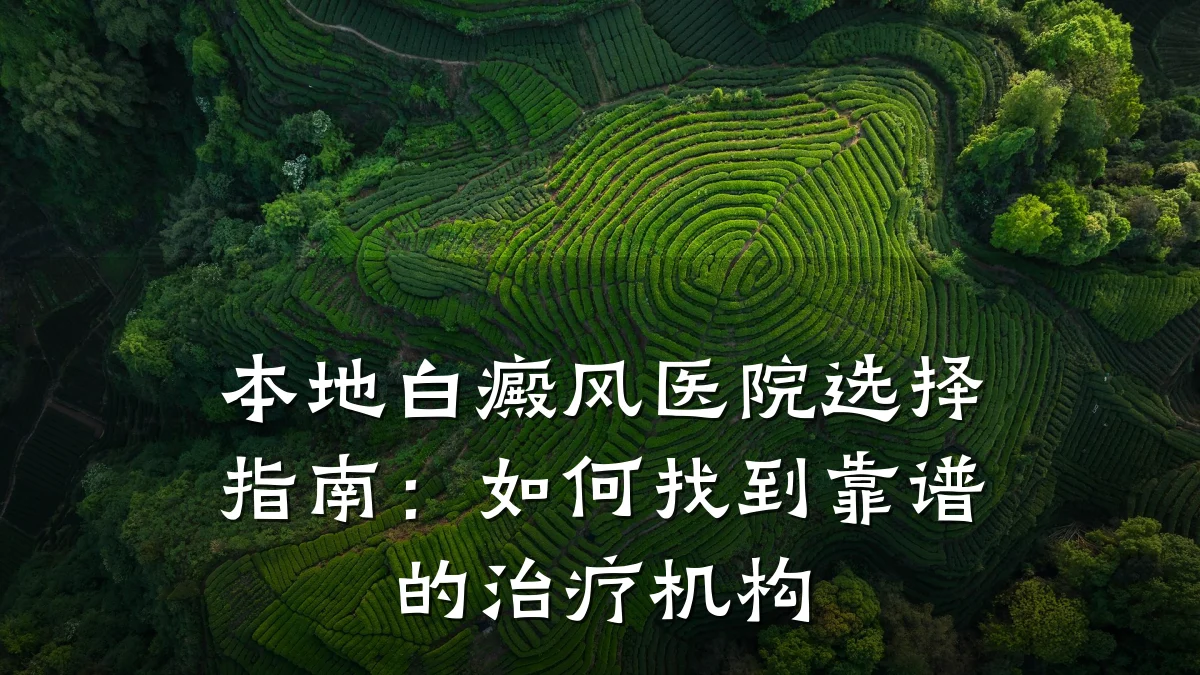 本地白癜风医院选择指南：如何找到靠谱的治疗机构