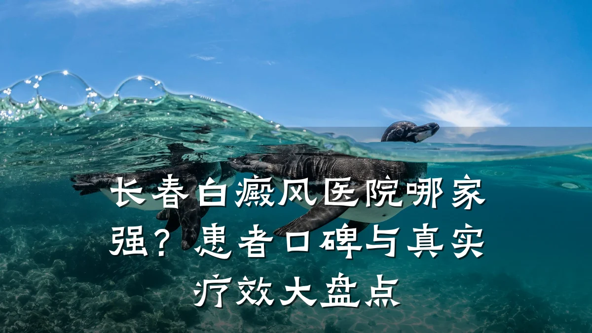 长春白癜风医院哪家强?患者口碑与真实疗效大盘点