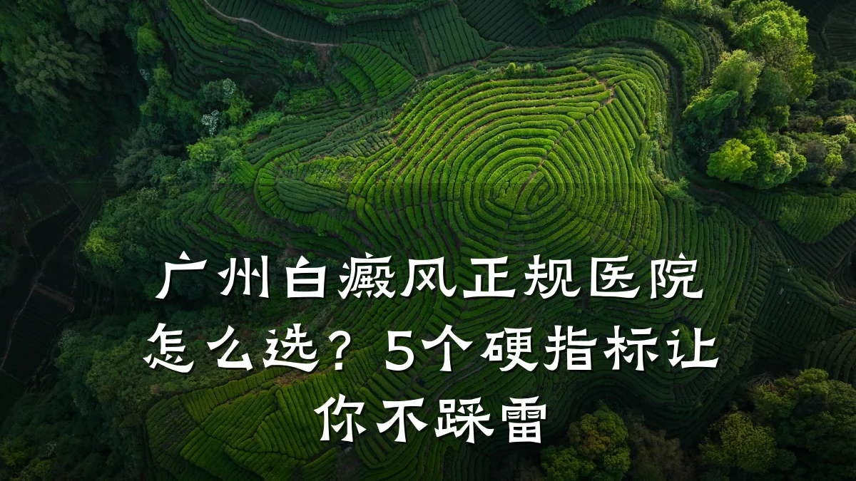 广州白癜风正规医院怎么选?5个硬指标让你不踩雷
