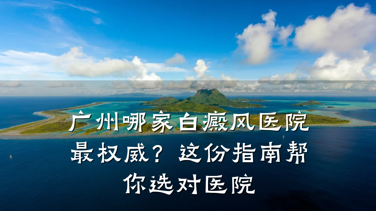 广州哪家白癜风医院最权威？这份指南帮你选对医院