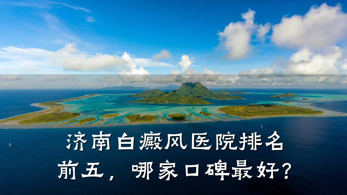 济南白癜风医院排名前五,哪家口碑最好?