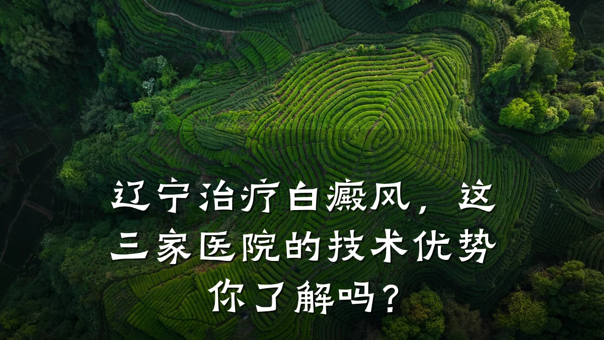 辽宁治疗白癜风,这三家医院的技术优势你了解吗?
