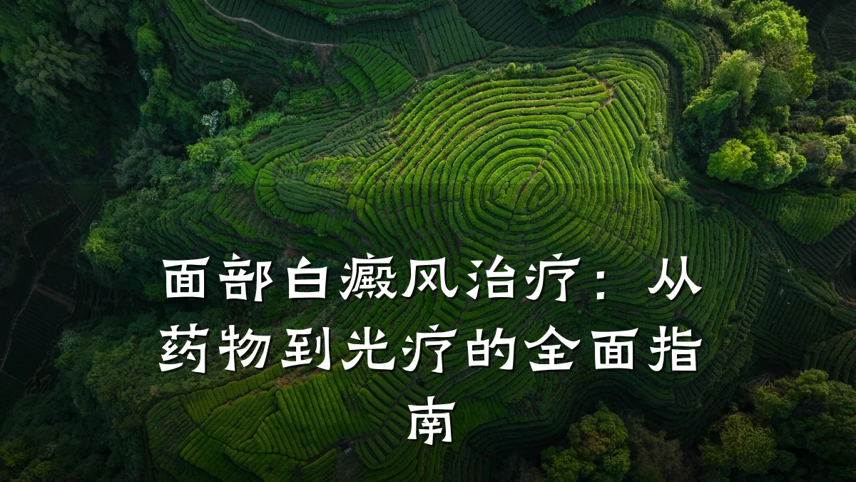 面部白癜风治疗:从药物到光疗的全面指南