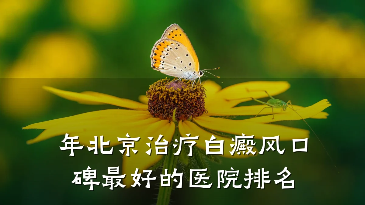 年北京治疗白癜风口碑最好的医院排名