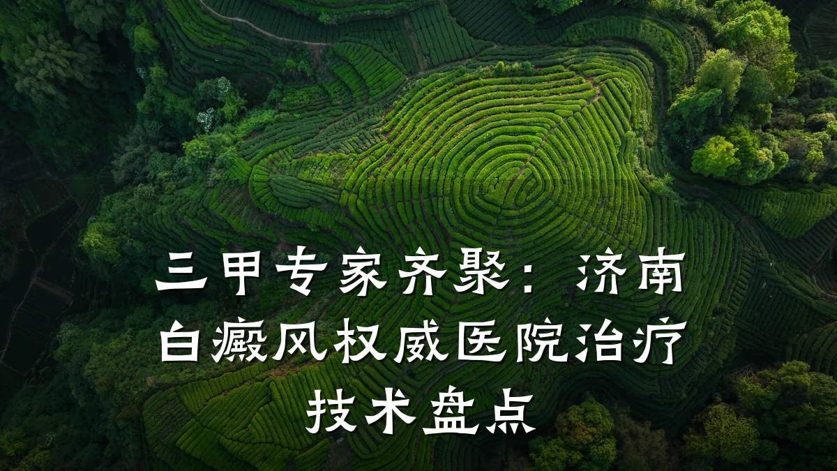 三甲专家齐聚:济南白癜风权威医院治疗技术盘点