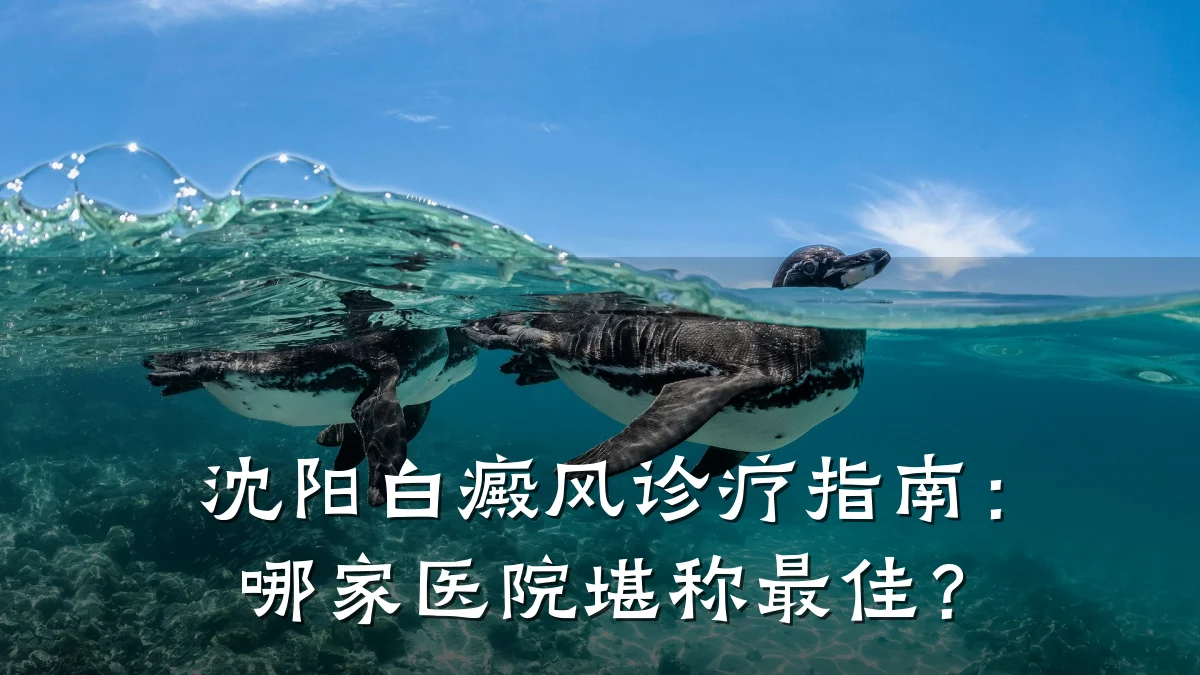 沈阳白癜风诊疗指南:哪家医院堪称最佳?