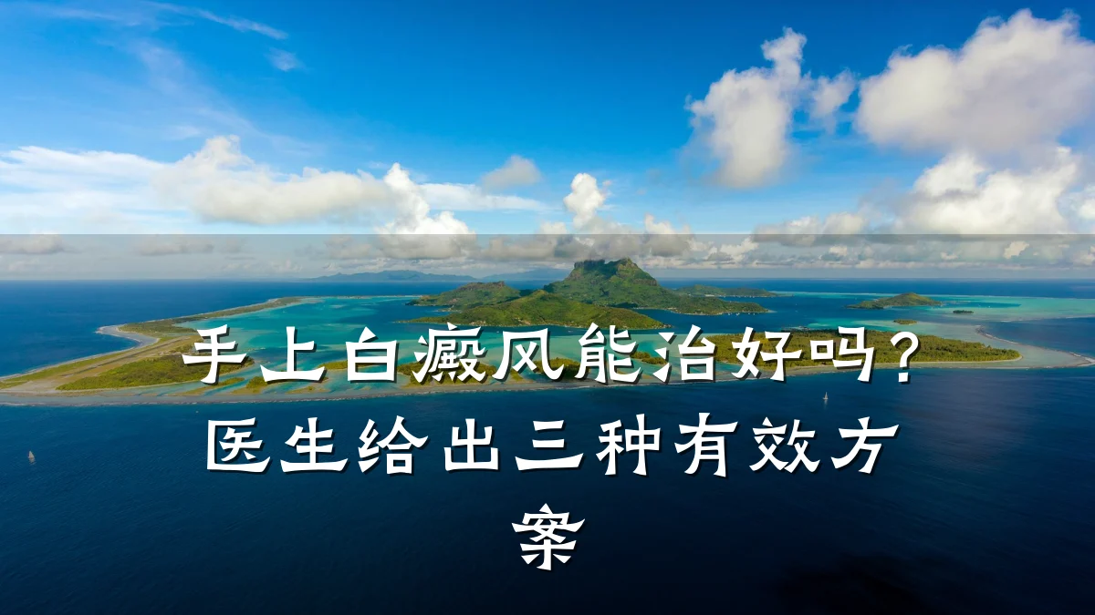 手上白癜风能治好吗?医生给出三种有效方案