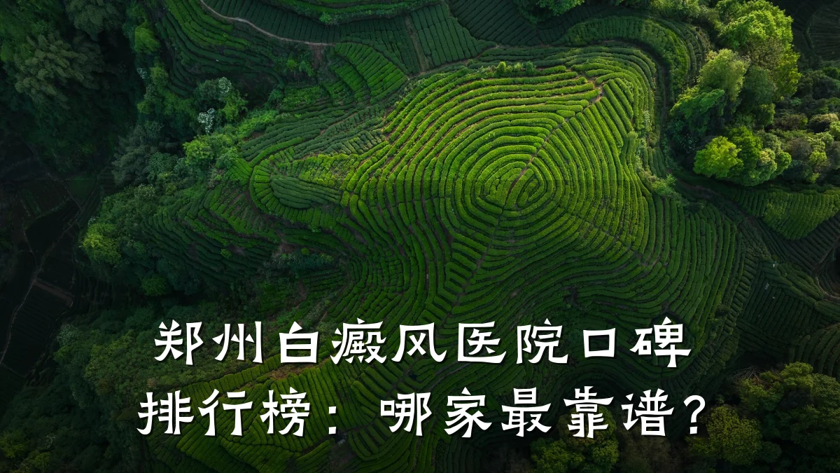 郑州白癜风医院口碑排行榜:哪家最靠谱?