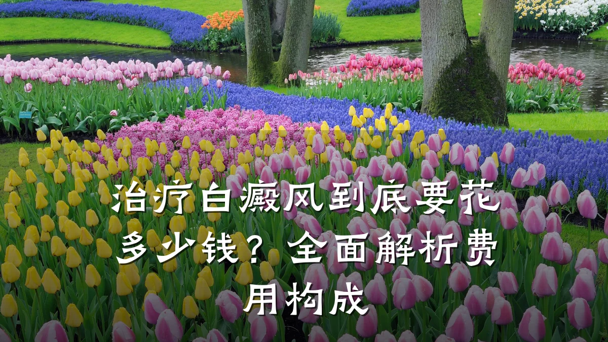 治疗白癜风到底要花多少钱?全面解析费用构成